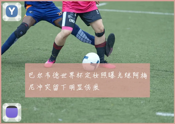 巴尔韦德世界杯定妆照曝光琼阿梅尼冲突留下明显伤痕